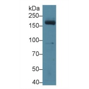 Western blot analysis of Mouse Serum, using Mouse MPO Antibody (3 µg/ml) and HRP-conjugated Goat Anti-Rabbit antibody (<a href="https://www.abbexa.com/index.php?route=product/search&amp;search=abx400043" target="_blank">abx400043</a>, 0.2 µg/ml).