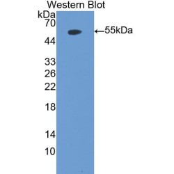 Myeloperoxidase (MPO) Antibody