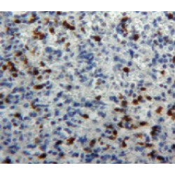 Myeloperoxidase (MPO) Antibody