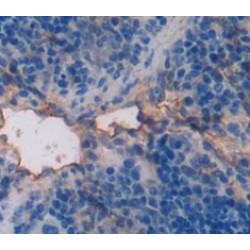 Pim-2 Oncogene (PIM2) Antibody