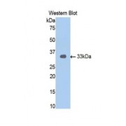Western blot analysis of recombinant Human AR.