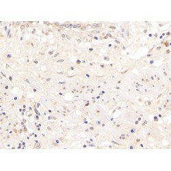 Androgen Receptor (AR) Antibody