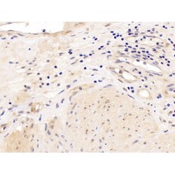 Androgen Receptor (AR) Antibody