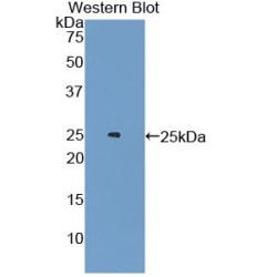 Androgen Receptor (AR) Antibody