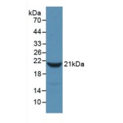 Western blot analysis of recombinant Rat FGa.