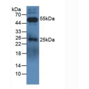 Western blot analysis of Dog Serum.