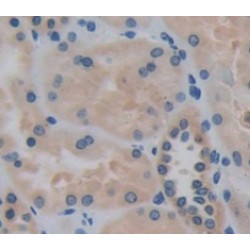 Inhibin Beta B (INHbB) Antibody