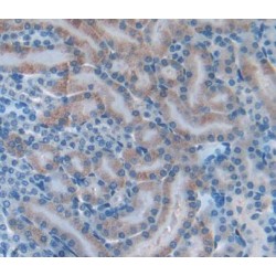 Inhibin Beta B (INHbB) Antibody