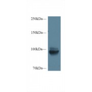 Western blot analysis of Mouse Kidney lysate, using Mouse MEP1a Antibody (1 µg/ml) and HRP-conjugated Goat Anti-Rabbit antibody (<a href="https://www.abbexa.com/index.php?route=product/search&amp;search=abx400043" target="_blank">abx400043</a>, 0.2 µg/ml).