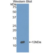 Western blot analysis of the recombinant protein.