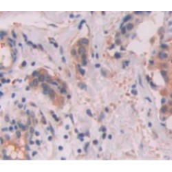 Semaphorin 3F (SEMA3F) Antibody