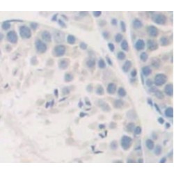 Semaphorin 5B (SEMA5B) Antibody