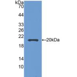 Semaphorin 5B (SEMA5B) Antibody