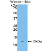 Western blot analysis of the recombinant protein.