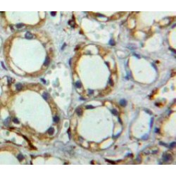 Tetraspanin 3 (TSPAN3) Antibody