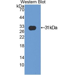 Actinin Alpha 2 (ACTN2) Antibody