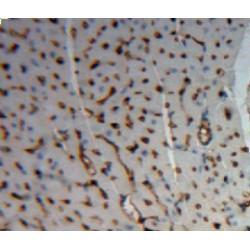 Actinin Alpha 2 (ACTN2) Antibody