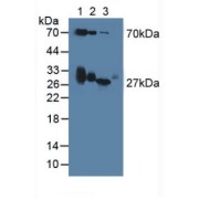 Western blot analysis of (1) Mouse Serum, (2) Mouse Blood Cells and (3) Mouse Spleen Tissue.