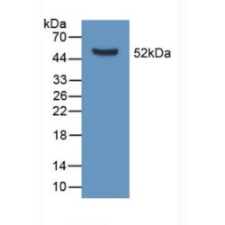 Apolipoprotein D (APOD) Antibody