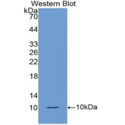 Western blot analysis of the recombinant protein.