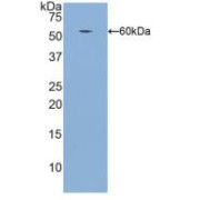 Western blot analysis of recombinant Human ITGb1 (with His and GST tags).