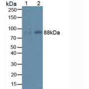 Western blot analysis of (1) Mouse Liver Tissue and (2) Mouse Lung Tissue.