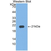 Western blot analysis of the recombinant protein.