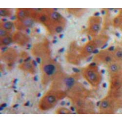 Interleukin 17C (IL17C) Antibody