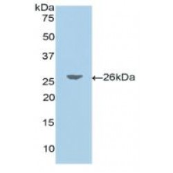 Jagged 1 Protein (JAG1) Antibody