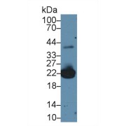 Western blot analysis of Mouse Liver lysate, using Mouse PRDX1 Antibody (2 µg/ml) and HRP-conjugated Goat Anti-Rabbit antibody (<a href="https://www.abbexa.com/index.php?route=product/search&amp;search=abx400043" target="_blank">abx400043</a>, 0.2 µg/ml).