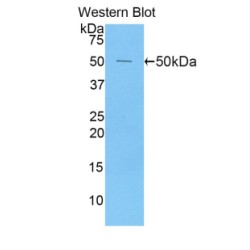 Peroxiredoxin 1 (PRDX1) Antibody