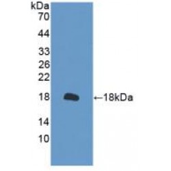 Peroxiredoxin 2 (PRDX2) Antibody