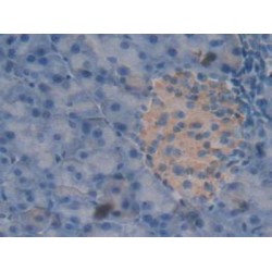 Peroxiredoxin 2 (PRDX2) Antibody