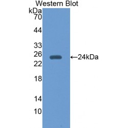 Peroxiredoxin 5 (PRDX5) Antibody