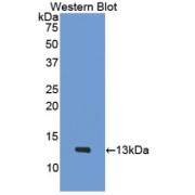 Western blot analysis of the recombinant protein.