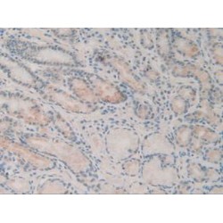 Sequestosome 1 (SQSTM1) Antibody