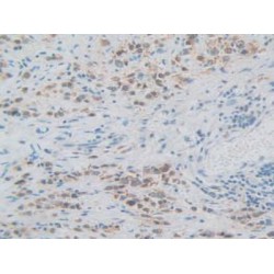 Sequestosome 1 (SQSTM1) Antibody