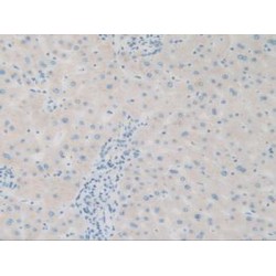 Sequestosome 1 (SQSTM1) Antibody