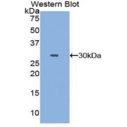 Topoisomerase II (TOP2) Antibody