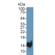 Western blot analysis of Rat Stomach lysate, using Rat TFF2 Antibody (1 µg/ml) and HRP-conjugated Goat Anti-Rabbit antibody (<a href="https://www.abbexa.com/index.php?route=product/search&amp;search=abx400043" target="_blank">abx400043</a>, 0.2 µg/ml).