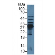 Western blot analysis of Mouse Liver lysate, using Rat CRP Antibody (3 µg/ml) and HRP-conjugated Goat Anti-Rabbit antibody (<a href="https://www.abbexa.com/index.php?route=product/search&amp;search=abx400043" target="_blank">abx400043</a>, 0.2 µg/ml).