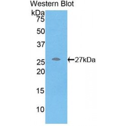 C Reactive Protein (CRP) Antibody