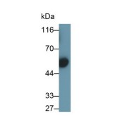 Western blot analysis of Human serum using Immunoglobulin G3 (IgG3) Antibody (0.1 µg/ml) and HRP-conjugated Goat Anti-Rabbit antibody (<a href="https://www.abbexa.com/index.php?route=product/search&amp;search=abx400043" target="_blank">abx400043</a>, 0.2 µg/ml).