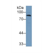 Western blot analysis of Human Lung lysate, using Human CFB Antibody (1 µg/ml) and HRP-conjugated Goat Anti-Rabbit antibody (<a href="https://www.abbexa.com/index.php?route=product/search&amp;search=abx400043" target="_blank">abx400043</a>, 0.2 µg/ml).