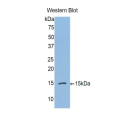 Complement Factor B (CFB) Antibody