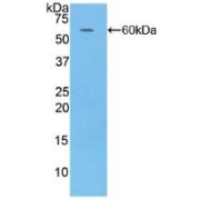 Western blot analysis of recombinant Human CFD.