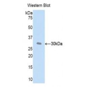 Western blot analysis of recombinant Mouse CFD.
