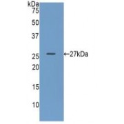 Western blot analysis of recombinant Human GUSb.