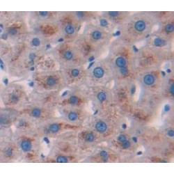 Glucuronidase Beta (GUSb) Antibody