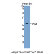 Western blot analysis of the recombinant protein.